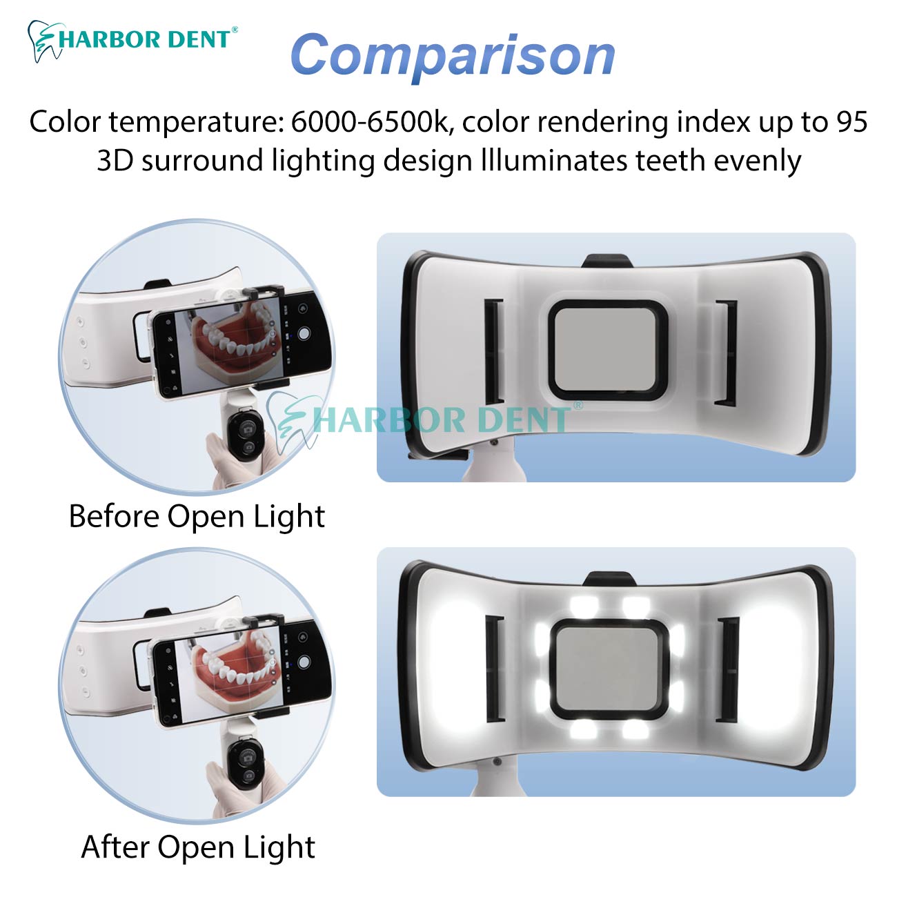 お手頃価格の歯科写真撮影用ツインフラッシュキット、明るさ調整 - Good Lighting In Photography のレビューと価格
